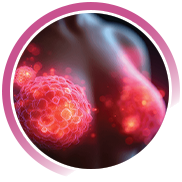 Cancer du sein avancé RE+/HER2- : résultats d’evERA Breast Cancer 
